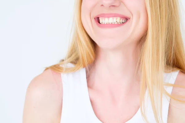 Emoción cara sonrisa mujer dientes dentista salud oral — Foto de Stock