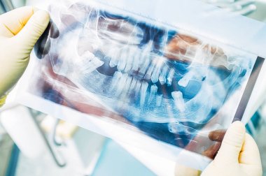 dentistry internship diagnostic panoramic x ray clipart