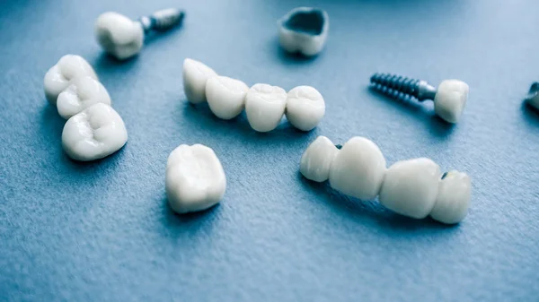Sebészeti fogszabályozás kerámia fogászati implantátumok — Stock Fotó