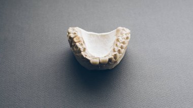 çene düzeni seramik metal protez diş protezi
