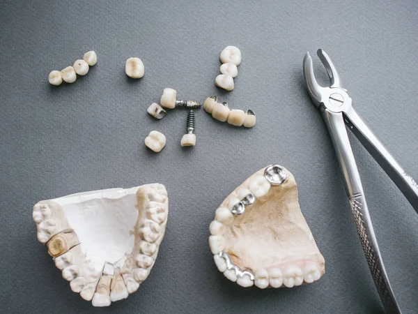歯科補綴顎入れ歯は、クラウン鉗子 — ストック写真
