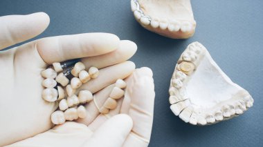 ortodontik onarım seramik diş implantlar eller