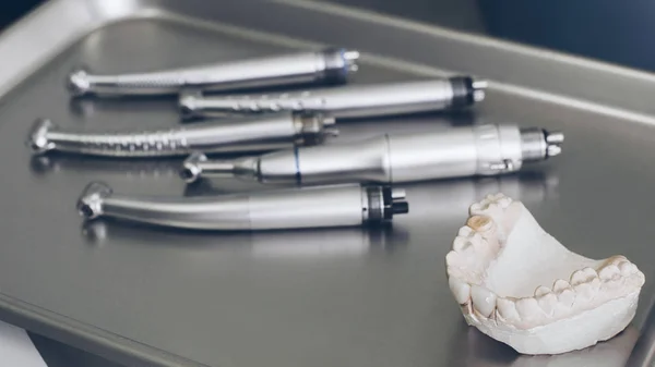 Ортодонтія гіпсова щелепа зубний лоток — стокове фото