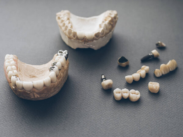 orthodontics prosthetics jaws dentures crowns