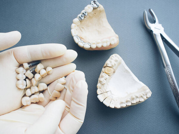 dental prosthesis equipment jaws dentures crowns