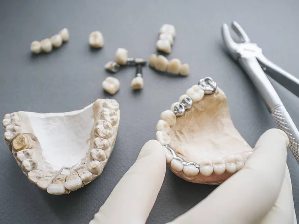 牙科假肢下颌假牙冠钳 — 图库照片