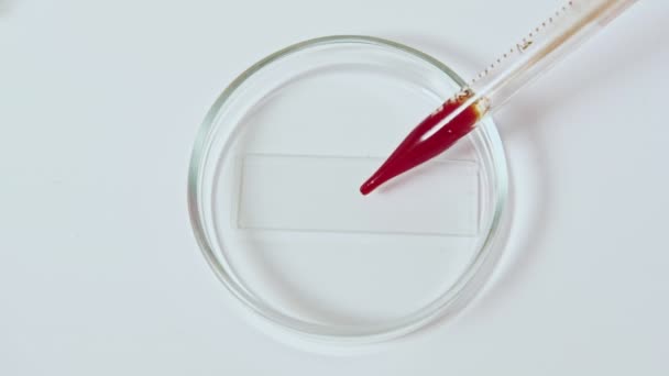 Blodprov händer rött prov petriskål pipett — Stockvideo