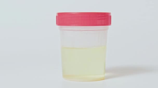 Urine test klinische diagnostiek handfles set 3 — Stockvideo