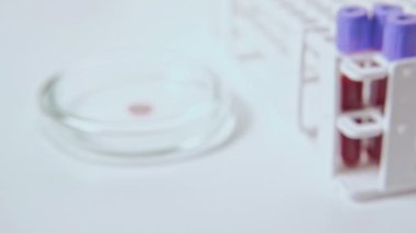 Kan örneği test eli kırmızı cam tüp