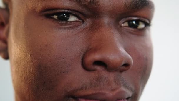 Masalah kulit perawatan wajah african man jerawat — Stok Video