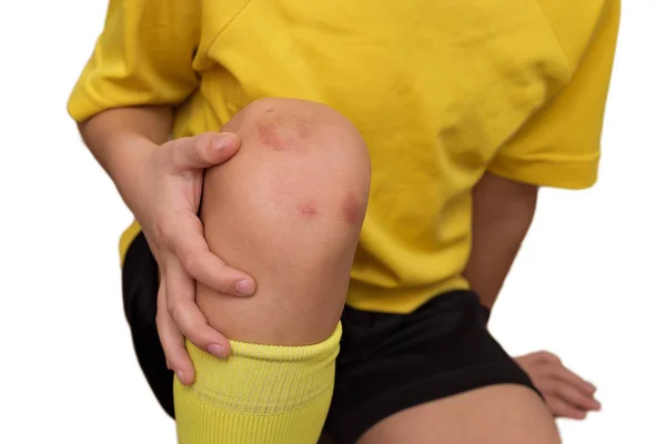 Kind Gekwetst Zijn Knie Tijdens Het Spelen Van Voetbal — Stockfoto