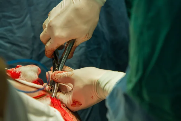 Close Mão Cirurgião Com Pinças Quebrando Osso Crânio — Fotografia de Stock