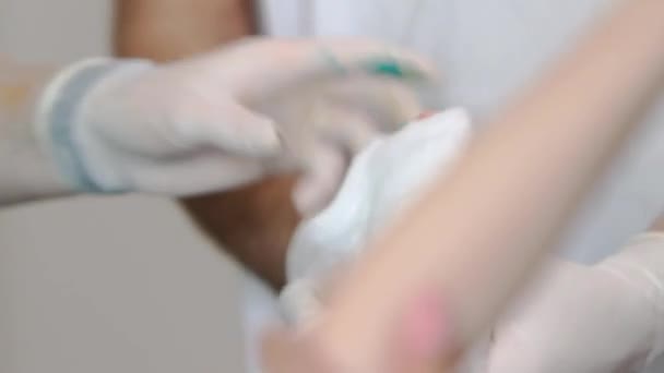 Die Ärzte Tragen Medizinische Baumwolle Auf Das Linke Bein Des — Stockvideo