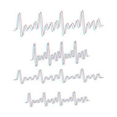 Çizgi vektör elektrokardiyogramı. Kalp atışı, tıbbi kardiyogram.