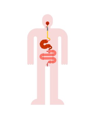 Metal sindirim sistemi. Demir mide ve bağırsaklar. Robot iç organı. Cyborg organları. Robot Gu