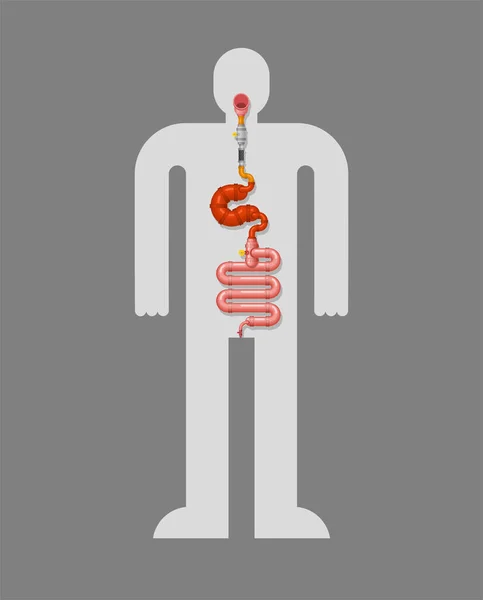 Metallo Allo Stomaco Intestino Organo Interno Robotico Ferro Tratto Digestivo — Vettoriale Stock