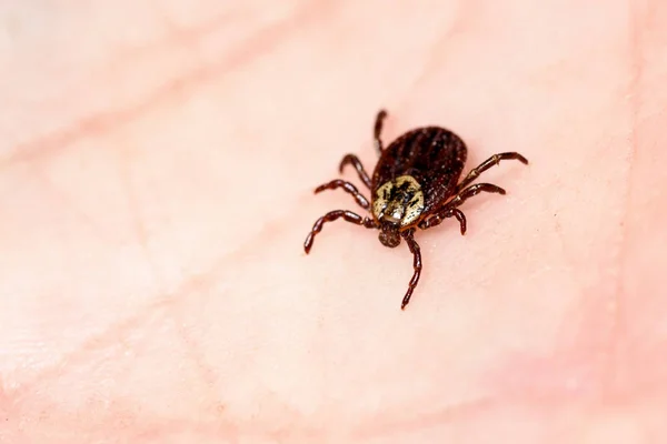 Mite Encefalit Mänsklig Hud — Stockfoto