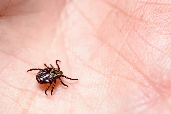 Mite Encephalitis Human Skin Stock Image