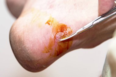 ayak ayakkabı ile ovuşturdu