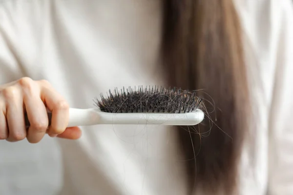 Hair Loss Woman Showing Her Hair Brush — Stock Photo, Image