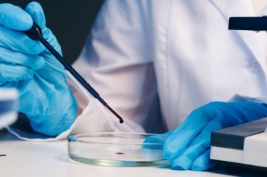 Kan testi yapan bir laboratuvar çalışanının elleri.