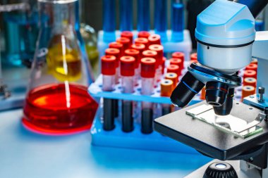 Mikroskobun fotoğrafını kan örnekleriyle birlikte test tüpleriyle kapat.