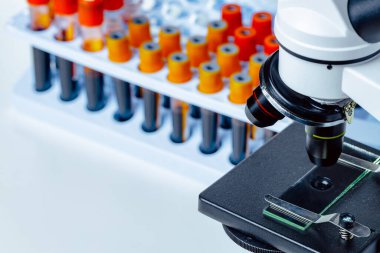 Kan örnekleri olan mikroskop test tüplerini kapatın.