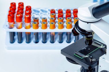 Kan örnekleri olan mikroskop test tüplerini kapatın.