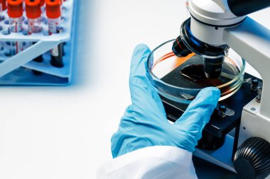 Kan testi yapan bir laboratuvar çalışanının elleri.