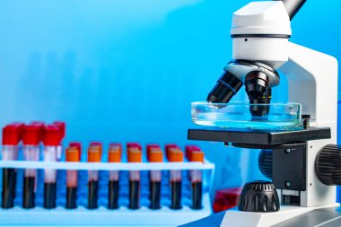 Mikroskobun fotoğrafını kan örnekleriyle birlikte test tüpleriyle kapat.