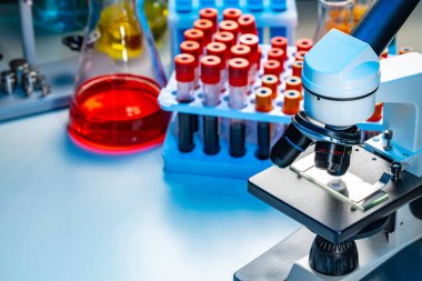 Mikroskobun fotoğrafını kan örnekleriyle birlikte test tüpleriyle kapat.