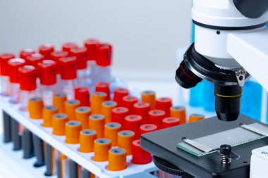 Kan örnekleri olan mikroskop test tüplerini kapatın.