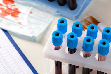 Test tüpleriyle lekeli tıbbi koruyucu maske. Coronavirus tanı ve tedavi analizi kavramı.