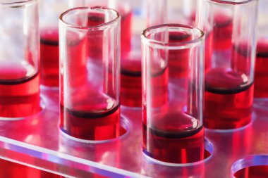 Test tüpleri tıbbi laboratuvar olarak düzenlenmiş kapatın. Tıbbi sağlık analiz Bağışıklık virüslere kavramı.