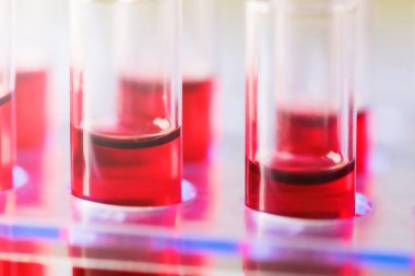 Test tüpleri tıbbi laboratuvar olarak düzenlenmiş kapatın. Tıbbi sağlık analiz Bağışıklık virüslere kavramı.