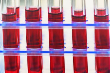 Test tüpleri tıbbi laboratuvar olarak düzenlenmiş kapatın. Tıbbi sağlık analiz Bağışıklık virüslere kavramı.