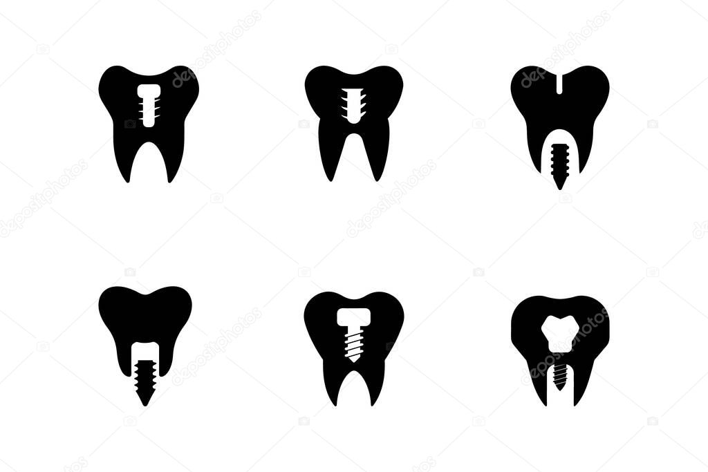 Icon Set Depicting Tooth Implant Variations and Structures Logo Vector Illustration