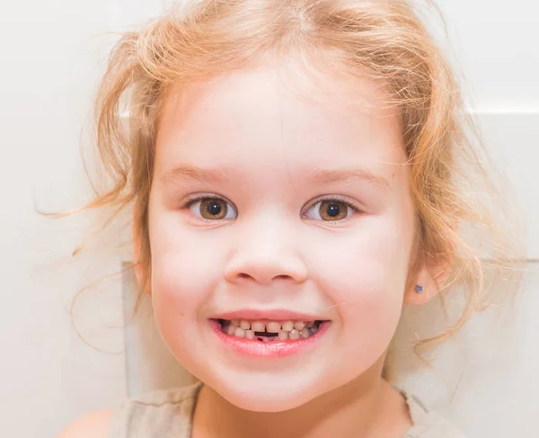 Girl Child Lost Tooth Hole Oral Hygiene — Stock Photo, Image
