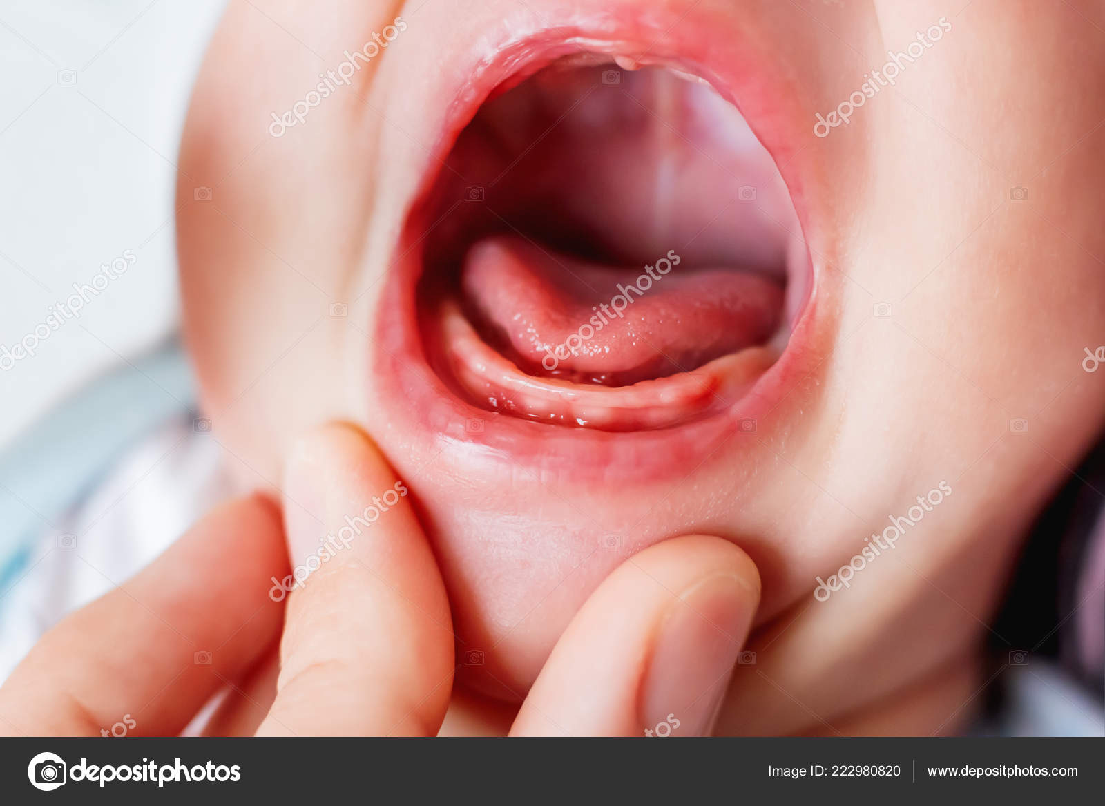 Gros Plan Photo Pleurer Mois Bouche Bebe Gommes Nues Sans Image Libre De Droit Par Aksenovko C