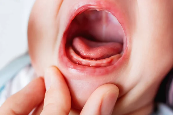 3ヶ月の赤ちゃんの口を泣いているの写真を閉じます 歯のない裸の歯茎 — ストック写真