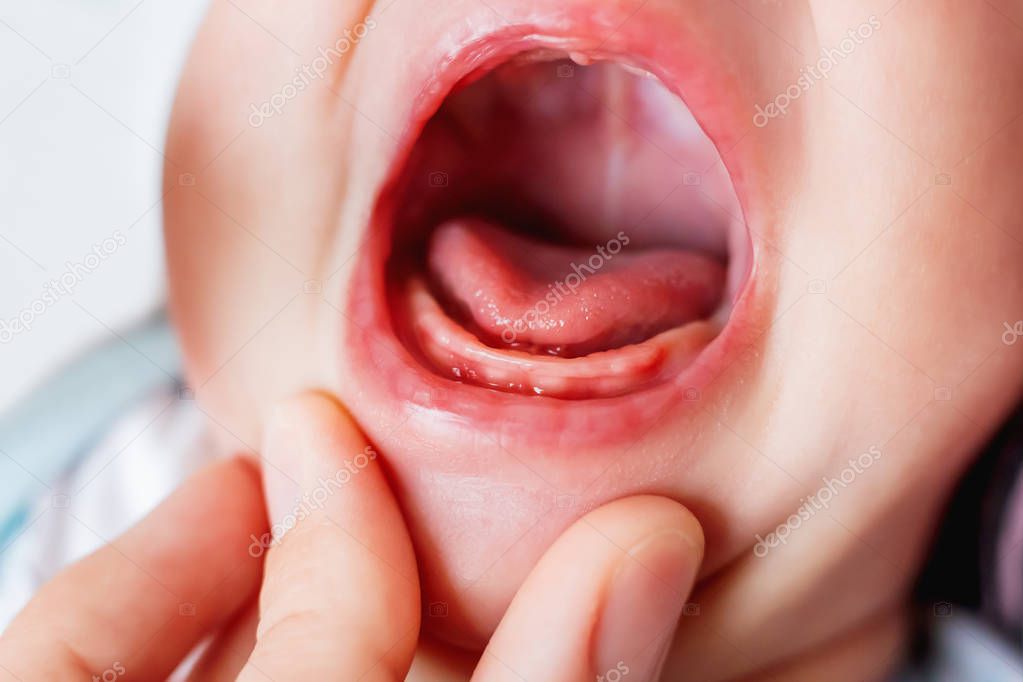 Close Photo Crying Months Old Baby Mouth Bare Gums Teeth