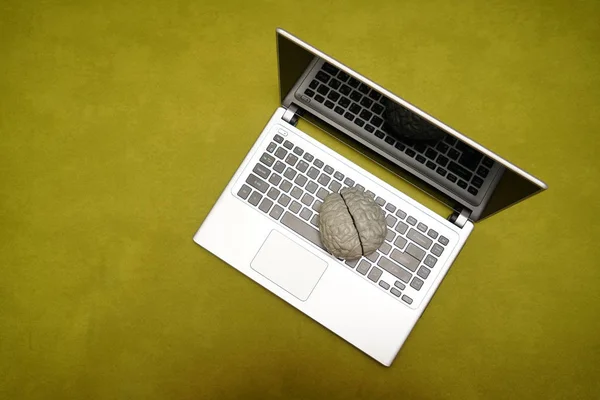 Draufsicht Auf Grauen Laptop Und Menschliches Gehirn Auf Tastatur — Stockfoto