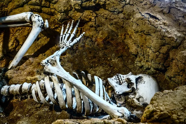 Mänsklig Skalle Och Ben Graven Spooky Skelett Med Tom Vodka — Stockfoto