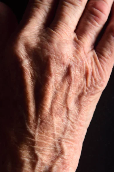Деталь Руки Пожилой Женщины — стоковое фото