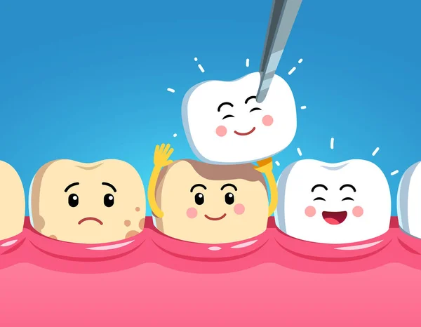 Funny cartoon teeth characters on gum and veneer — Stock Vector