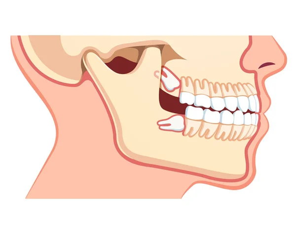 Mänskliga käkar modell med tänder rad. Tandvård — Stock vektor