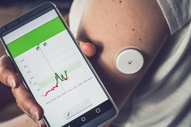 Kadın uzak bir sensör ve cep telefonu ile glikoz seviyesini kontrol, sensör kontrol glikoz düzeyleri kan olmadan, iyi sonuç. Diyabet tedavisi.