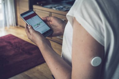 Uzak bir sensör ve cep telefonu ile glikoz seviyesini kontrol kadın, sensör kontrol kan olmadan glikoz düzeyleri kontrol, kötü sonuç. Diyabet tedavisi. Arka plana odaklanın.