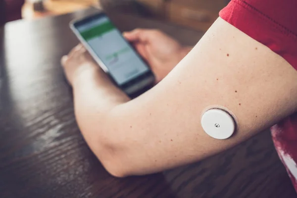 Kadın uzak bir sensör ve cep telefonu ile glikoz seviyesini kontrol, sensör kontrol glikoz düzeyleri kan olmadan, iyi sonuç. Diyabet tedavisi. Ön plana odaklanın.