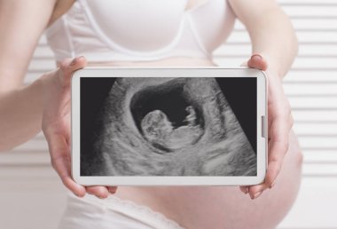 Hamile kadın tutarak ve dijital tablet cenin ultrason fotoğraf ile beyaz ahşap arka plan üzerinde gösterilen iç çamaşırı. Yakın çekim.